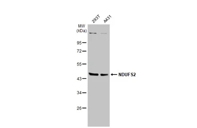 Anti-NDUFS2 antibody used in Western Blot (WB). GTX114924