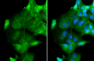 Anti-Occludin antibody used in Immunocytochemistry/ Immunofluorescence (ICC/IF). GTX114949