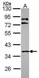 Anti-LIMS1 antibody [N1C2] used in Western Blot (WB). GTX114984