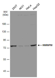 Anti-hnRNP M antibody [N1N2], N-term used in Western Blot (WB). GTX114999