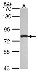 Anti-PLCD1 antibody [C1C3] used in Western Blot (WB). GTX115009
