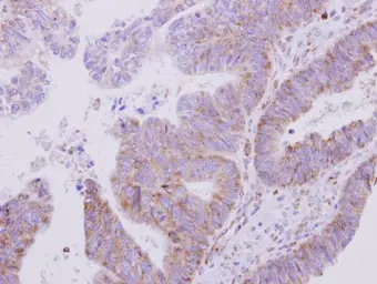 Anti-Valyl tRNA synthetase antibody [N1N2], N-term used in IHC (Paraffin sections) (IHC-P). GTX115015