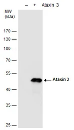 Anti-Ataxin 3 antibody used in Western Blot (WB). GTX115032
