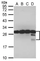 Anti-TPD52 antibody used in Western Blot (WB). GTX115042