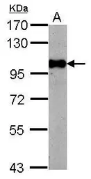 Anti-BRD3 antibody used in Western Blot (WB). GTX115058