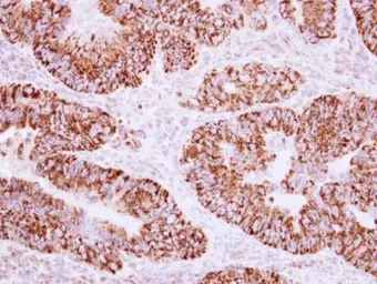 Anti-AKAP1 antibody [N1N2], N-term used in IHC (Paraffin sections) (IHC-P). GTX115067