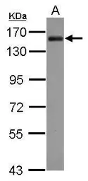 Anti-AKAP1 antibody [N1N2], N-term used in Western Blot (WB). GTX115067