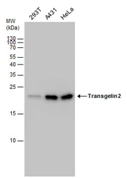 Anti-Transgelin 2 antibody [N1C3] used in Western Blot (WB). GTX115082