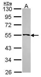 Anti-RRP1 antibody used in Western Blot (WB). GTX115107
