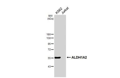 Anti-ALDH1A2 antibody [C1C3] used in Western Blot (WB). GTX115148
