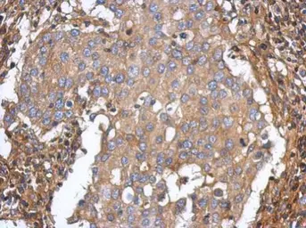 Anti-ST3GAL5 antibody [N3C3] used in IHC (Paraffin sections) (IHC-P). GTX115152