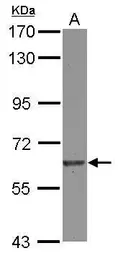 Anti-EIF2B delta antibody used in Western Blot (WB). GTX115155