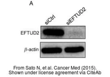 Anti-EFTUD2 antibody [C1C3] used in Western Blot (WB). GTX115222