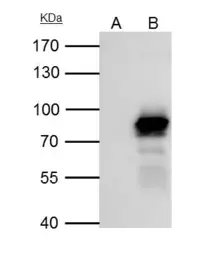 Anti-PLAP antibody [N3C2], Internal used in Immunoprecipitation (IP). GTX115226