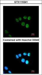 Anti-TRAP80 antibody [C1C3] used in Immunocytochemistry/ Immunofluorescence (ICC/IF). GTX115241