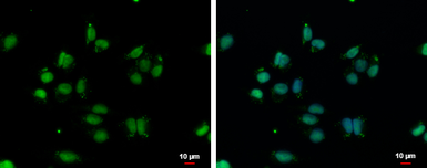 Anti-VPS4B antibody [N3C3] used in Immunocytochemistry/ Immunofluorescence (ICC/IF). GTX115249