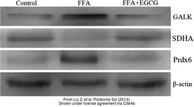 Anti-Peroxiredoxin 6 antibody used in Western Blot (WB). GTX115262