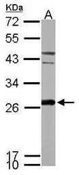 Anti-Peroxiredoxin 6 antibody used in Western Blot (WB). GTX115262