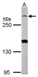 Anti-Myomegalin antibody [N1], N-term used in Western Blot (WB). GTX115270