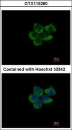 Anti-Pumilio 1 antibody [C2C3], C-term used in Immunocytochemistry/ Immunofluorescence (ICC/IF). GTX115280