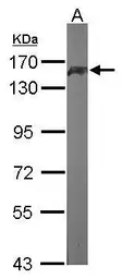 Anti-Pumilio 1 antibody [C2C3], C-term used in Western Blot (WB). GTX115280