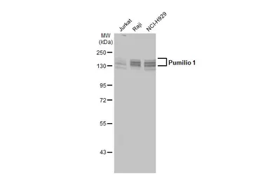 Anti-Pumilio 1 antibody [C2C3], C-term used in Western Blot (WB). GTX115280