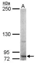 Anti-RNF10 antibody used in Western Blot (WB). GTX115316