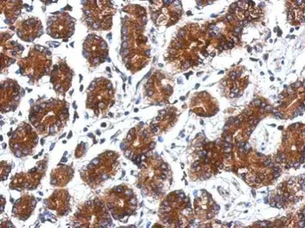 Anti-p16 ARC antibody used in IHC (Paraffin sections) (IHC-P). GTX115342