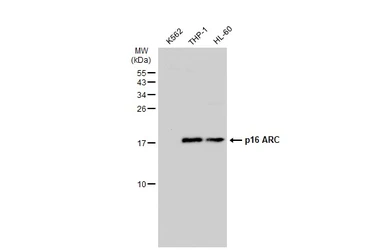 Anti-p16 ARC antibody used in Western Blot (WB). GTX115342