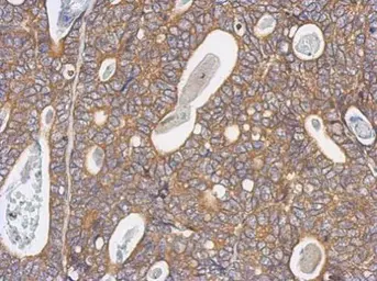 Anti-Arp3 antibody used in IHC (Paraffin sections) (IHC-P). GTX115345