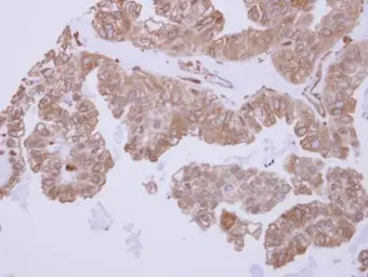 Anti-ACTR1B antibody used in IHC (Paraffin sections) (IHC-P). GTX115347