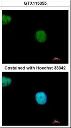 Anti-YAF2 antibody used in Immunocytochemistry/ Immunofluorescence (ICC/IF). GTX115355