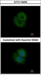 Anti-Coronin 2B antibody [N1C1] used in Immunocytochemistry/ Immunofluorescence (ICC/IF). GTX115405