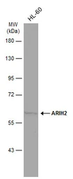 Anti-ARIH2 antibody used in Western Blot (WB). GTX115410
