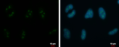 Anti-ARIH2 antibody used in Immunocytochemistry/ Immunofluorescence (ICC/IF). GTX115410