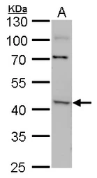 Anti-ACAA2 antibody used in Western Blot (WB). GTX115416