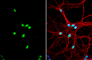 Anti-SAM68 antibody [N2C3] used in Immunocytochemistry/ Immunofluorescence (ICC/IF). GTX115462
