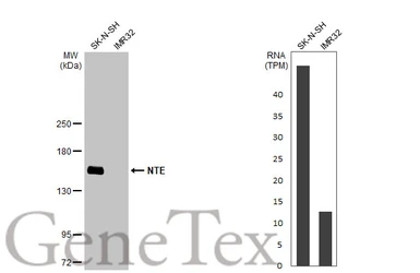 Anti-NTE antibody used in Western Blot (WB). GTX115501