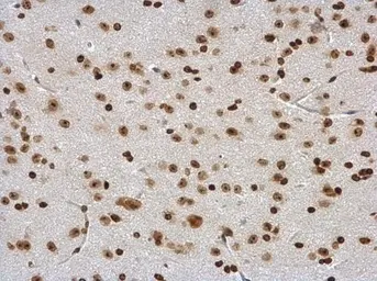 Anti-DDX56 antibody used in IHC (Paraffin sections) (IHC-P). GTX115551