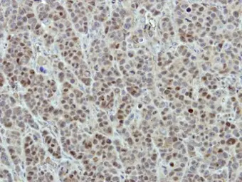 Anti-DDX56 antibody used in IHC (Paraffin sections) (IHC-P). GTX115551
