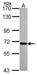 Anti-DDX56 antibody used in Western Blot (WB). GTX115551