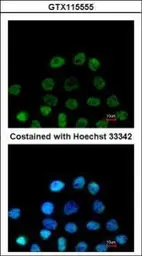 Anti-RbAp48 antibody [N3C3] used in Immunocytochemistry/ Immunofluorescence (ICC/IF). GTX115555