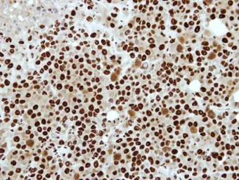 Anti-RbAp48 antibody [N3C3] used in IHC (Paraffin sections) (IHC-P). GTX115555