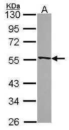 Anti-RbAp48 antibody [N3C3] used in Western Blot (WB). GTX115555