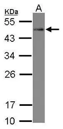 Anti-STYXL1 antibody used in Western Blot (WB). GTX115567