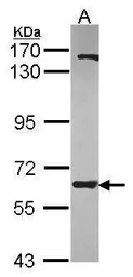Anti-ANKHD1 antibody [N1], N-term used in Western Blot (WB). GTX115568