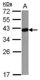 Anti-LDB3 antibody used in Western Blot (WB). GTX115593