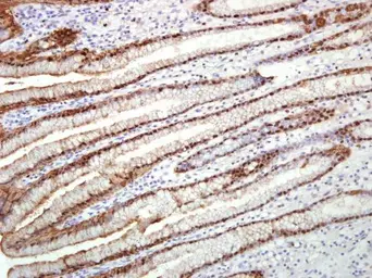 Anti-Annexin A10 antibody [N1C1] used in IHC (Paraffin sections) (IHC-P). GTX115600