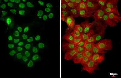 Anti-U2AF65 antibody [C1C3] used in Immunocytochemistry/ Immunofluorescence (ICC/IF). GTX115622