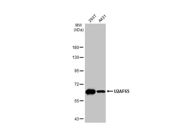 Anti-U2AF65 antibody [C1C3] used in Western Blot (WB). GTX115622